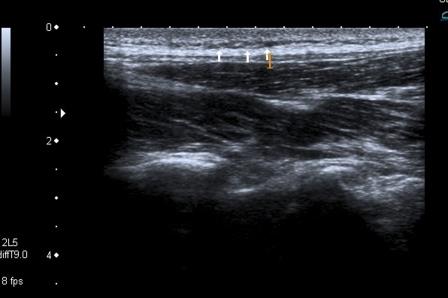 Fig 2. Dermatosis ecoPS Davener 2